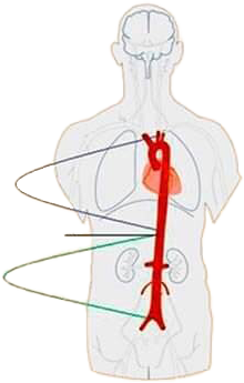 Aorta position in body