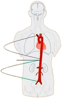 Aorta position in body