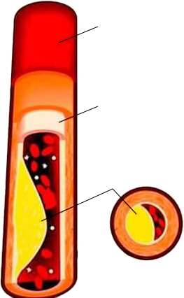 Aorta