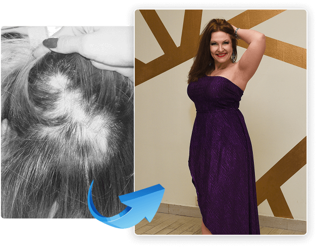 a photo before and after treatment