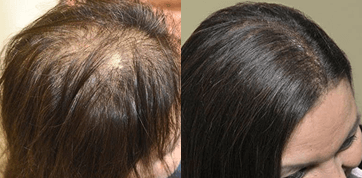 photo before and after