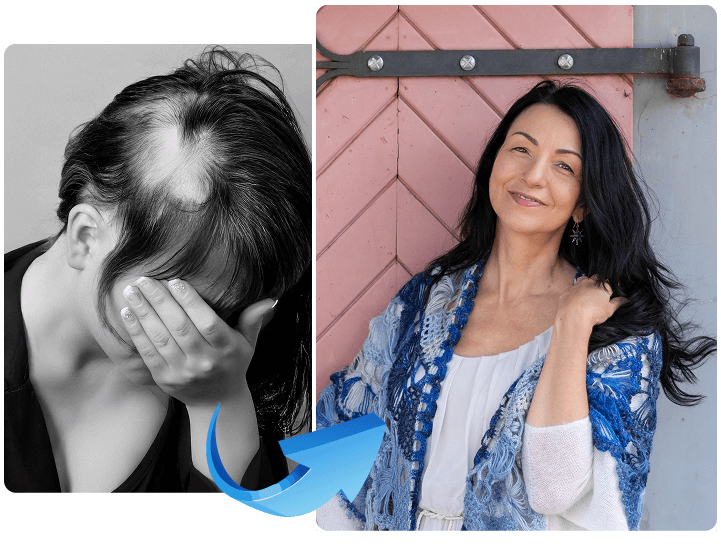 a photo before and after treatment