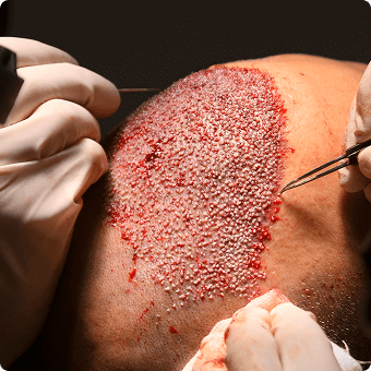 competitor visualisation