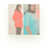 Photo before after