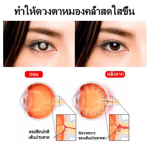 ATTDX Treatment EyeProblems SolutionDrops