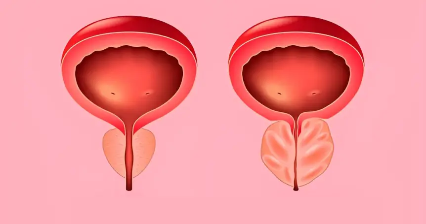 normal and not normal prostate